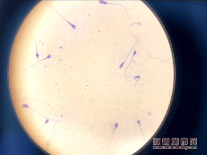 想要充分了解精子质量，离不开男科实验室的帮助。.jpg